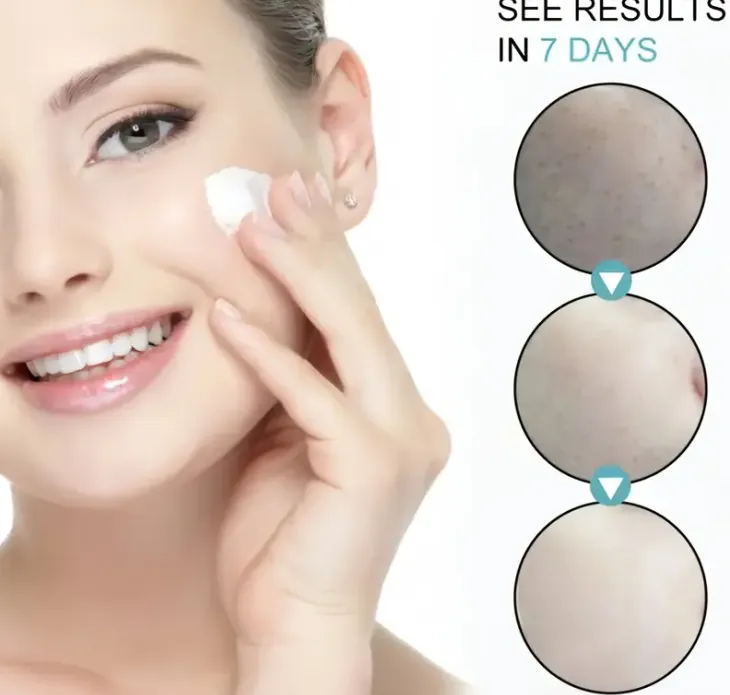 Dark Spot Remover For Face, Dark Spot Cream