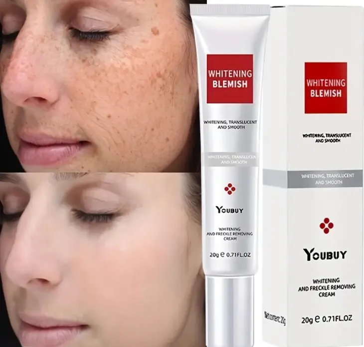Whitening And Freckle Removing Dark Spot Remover Cream, 7 Days To Remove Dark Spot