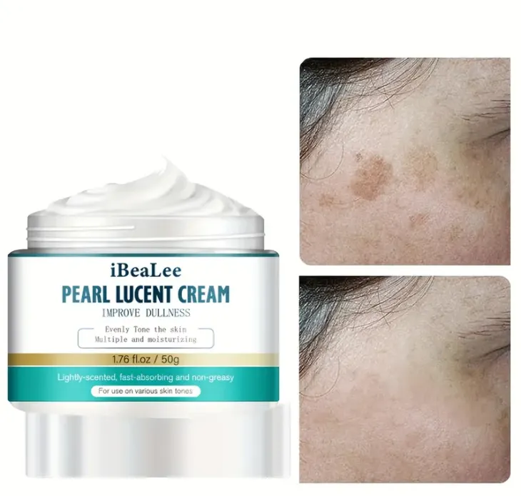 Dark Spot Remover For Face, Dark Spot Cream